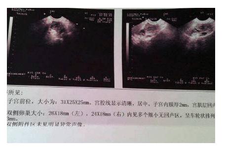 一分钟看懂b超图,一分钟看b超