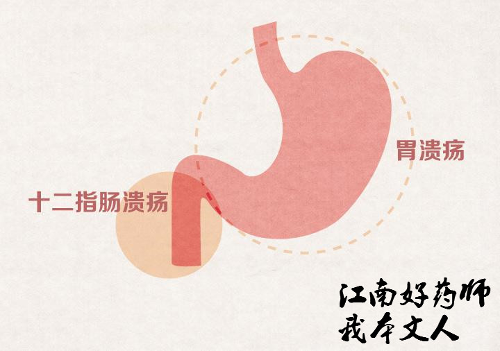 西医治疗胃病的最好方法,胃病西医顶级疗法