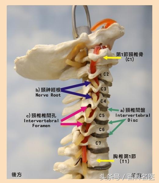 转脖子咔咔响肩颈痛,转脖子颈椎响怎么回事
