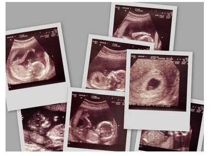 一分钟看懂b超图,一分钟看b超