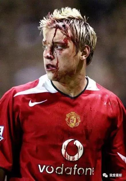 他拒绝亲吻曼联队徽，却为红魔断腿流血从不后悔！这才是真斗士