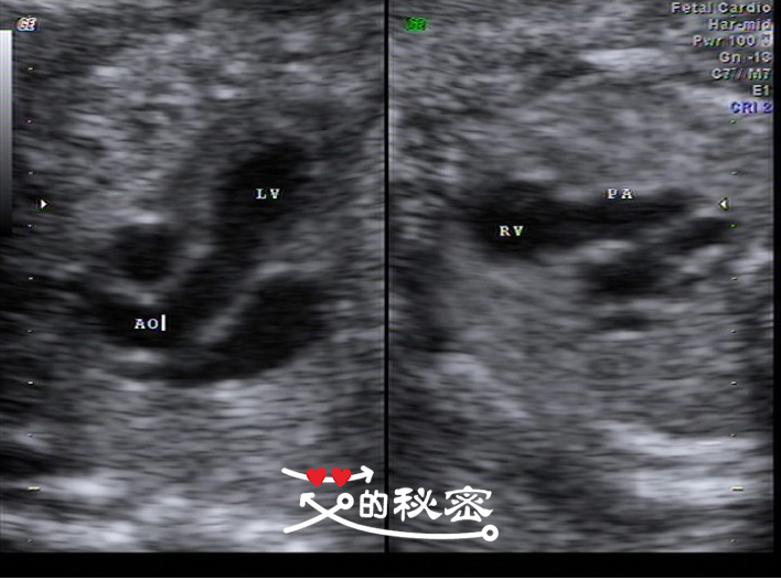 四维空间神秘事件,揭秘四维的存在