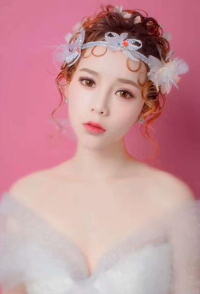 韩式三点定位恢复图片,韩式三点双眼皮恢复一个月图片