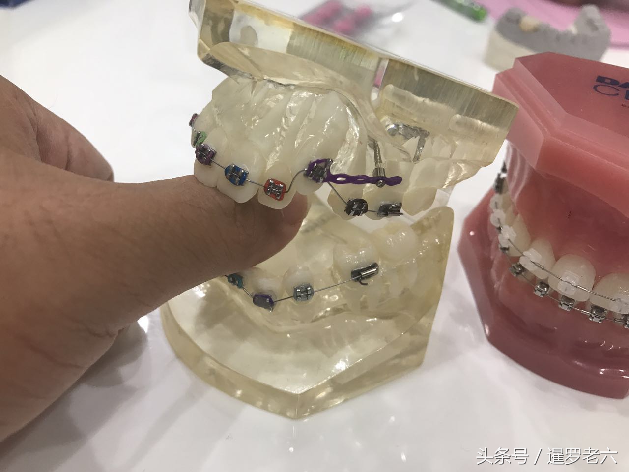 泰国曼谷医院补牙哪家好,在泰国曼谷做美白牙齿价格多少