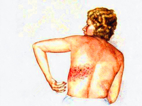 牙痛杀神经用的是什么药,治牙疼的药能治神经痛吗