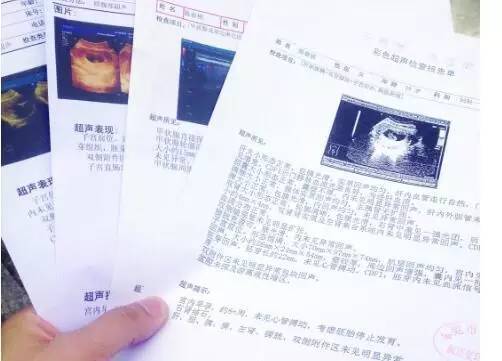 愤怒！医生渎职酿悲剧，孕妈一定要懂得胎动常识