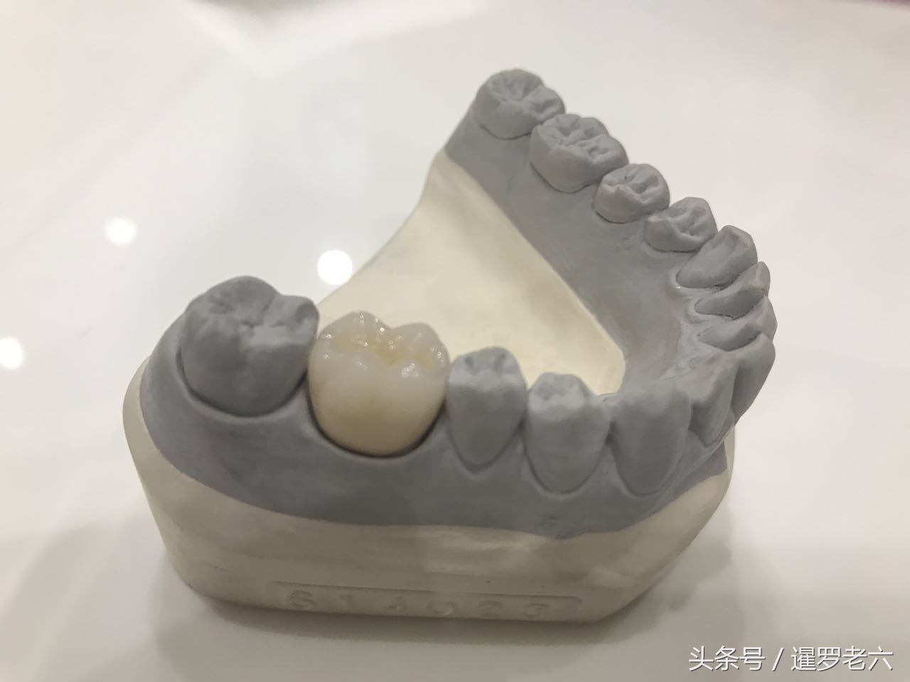 泰国曼谷医院补牙哪家好,在泰国曼谷做美白牙齿价格多少