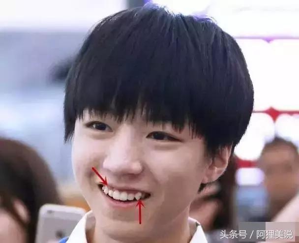 隐适美隐形矫正摘戴、保养关注事项全攻略