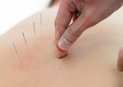 背痛有很多，伤筋最常见，这些方法很管用，但却很少人知道！