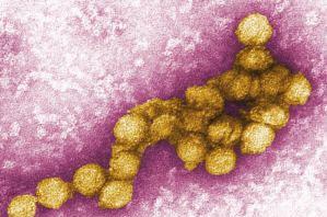 世界十大瘟疫对人类造成的伤害,人类历史上的十大病毒瘟疫