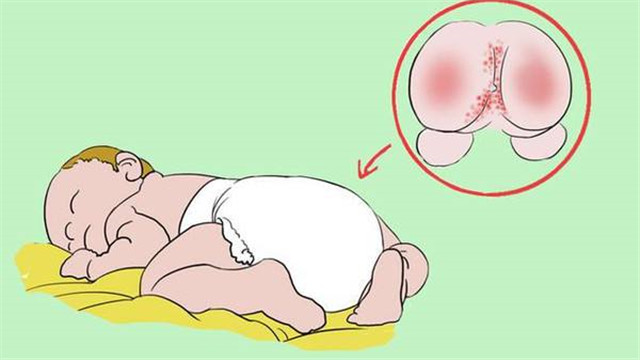 小宝宝红屁股反反复复怎么办,宝宝红屁股怎么办最有效的方法