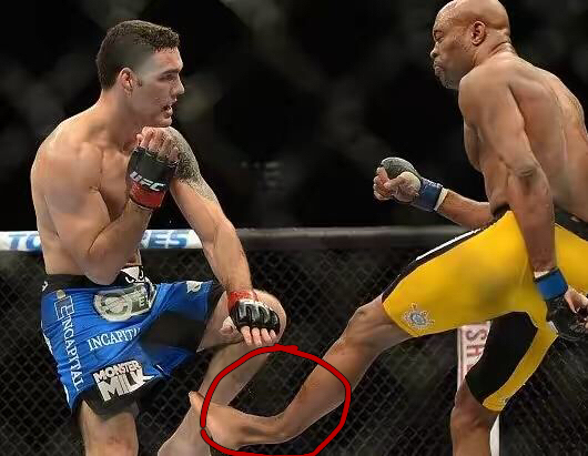 踢别人会把自己腿踢断吗,ufc踢断腿的那个人是谁