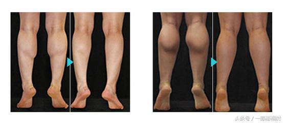 怎样瘦小腿肚最有效方法,怎么瘦小腿肚又快又有效学生党