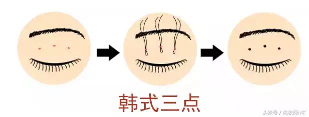 真实贴双眼皮贴,单眼皮怎么贴第二天变双眼皮