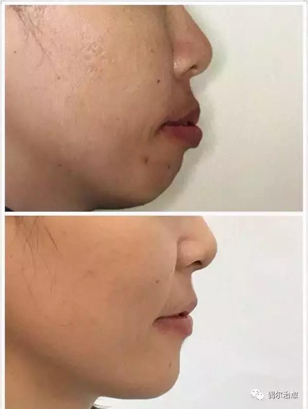 牙齿对人面貌的影响,一张图让你明白牙齿影响全身健康