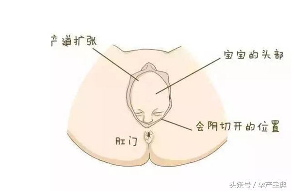 顺产侧切好还是剖腹产对女人好,剖腹产和顺产侧切对比