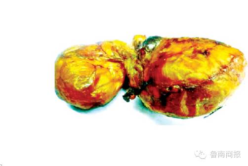 沂水一母猪体内现宝物？价值连城？