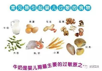 婴儿面部湿疹怎么护理效果最好,湿疹的护理方法与关注事项