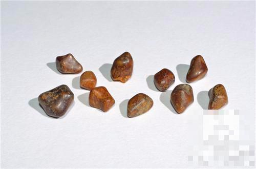 胆结石为什么吃太饱会痛,为什么会得胆结石要关注哪些饮食