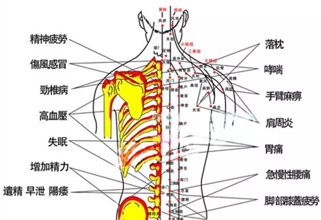 拔罐后关注事项与禁忌,你知道拔火罐用什么罐吗