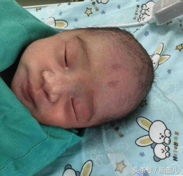 34周早产宝宝有4.2斤正常吗,34周早产宝宝18天长了1.4斤少吗