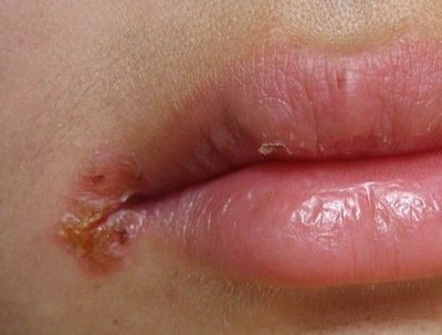 宝宝如何应对初春的忽冷忽热,冬季如何照顾宝宝不受凉