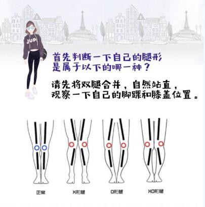 腿不直矫正的正确方法,腿不直可以矫正过来吗