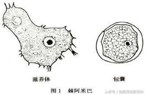 英国妹子用失明的教训告诉你，千万别让隐形眼镜沾上水