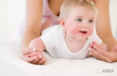 婴儿面部湿疹怎么护理效果最好,湿疹的护理方法与关注事项