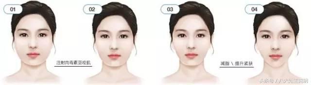 肉毒素咬肌可以完全消除吗,肉毒素能改善咬肌肥大吗