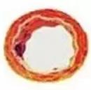 血管衰老怎么补充营养,血管衰老保健案例