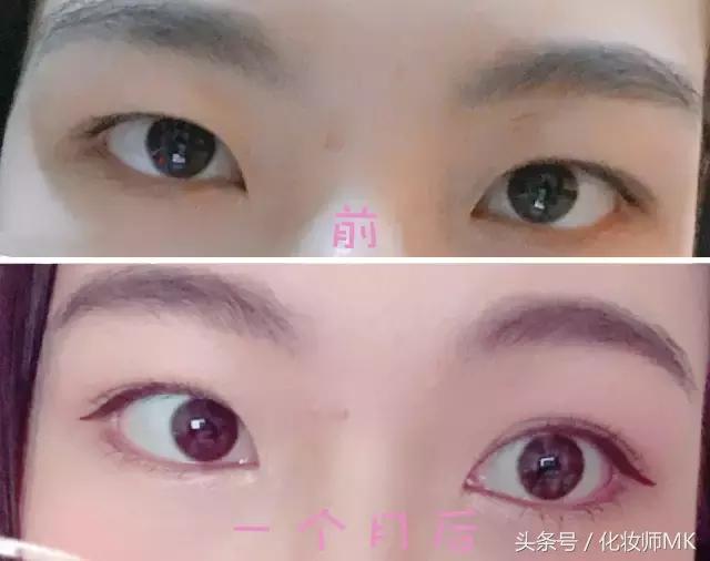 真实贴双眼皮贴,单眼皮怎么贴第二天变双眼皮