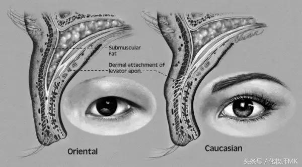 真实贴双眼皮贴,单眼皮怎么贴第二天变双眼皮