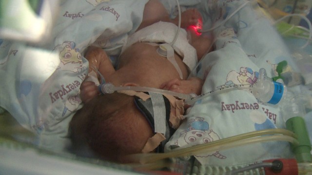 意外怀三胎要崩溃了,意外生的三胎