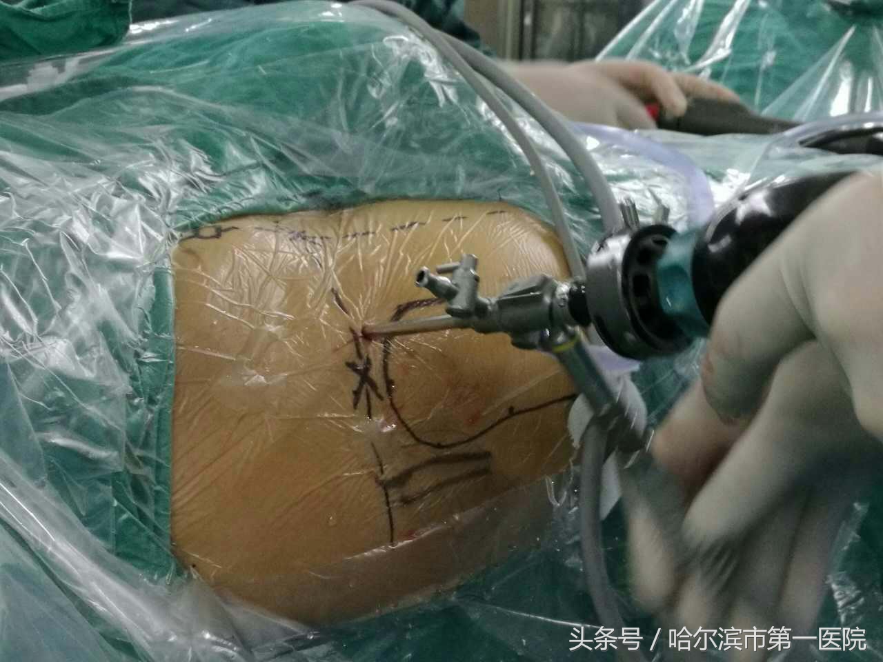 走路胯疼最快缓解方法,走路胯骨响怎么纠正