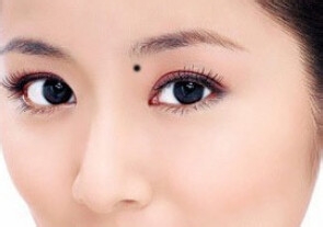 脸上有痣很难看要不要去点掉呢,脸上痣变美