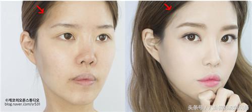 脸长嘴凸怎么办,鼻头大鼻翼宽怎么化妆改善