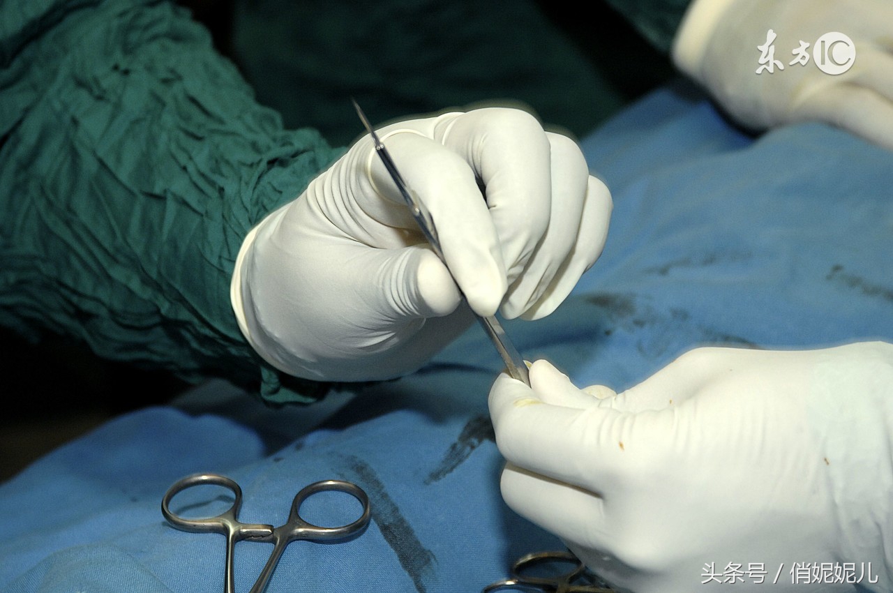 产科医生侧切,医院侧切有套路吗