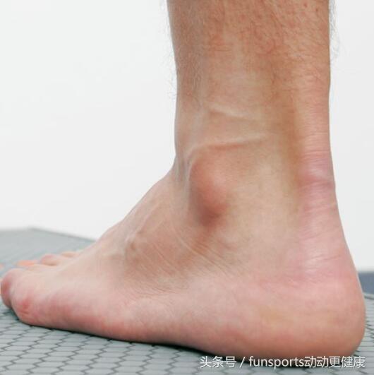足球运动员的跟腱怎么才算合格,跟腱受伤的足球运动员