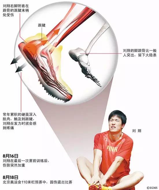 跟腱损伤中医如何治疗,跟腱损伤后的康复方法有哪些呢