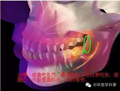 长智齿朋友圈说说心情,智齿的说说