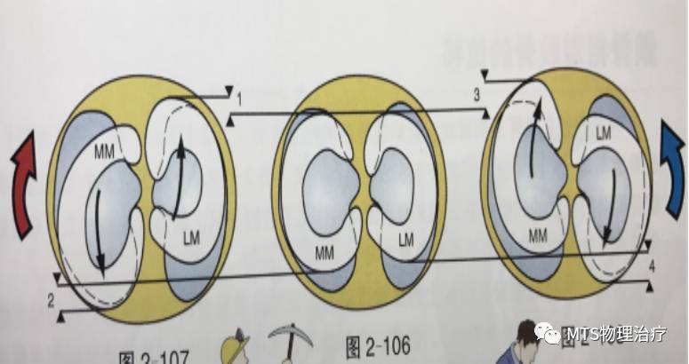 半月板撕裂,半月板资料