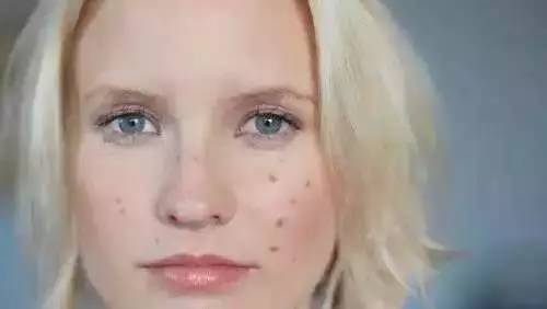 祛痘印的小窍门书籍,真正有用的祛痘印方法