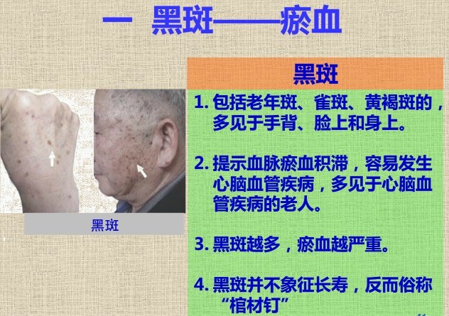 青筋跟血液循环有关吗,青筋的来源