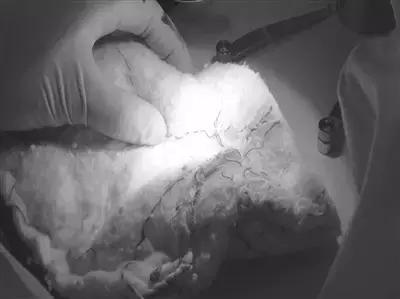 被子晒完太阳真的是螨虫的味道吗,晒过太阳的被子香味是螨虫尸体吗