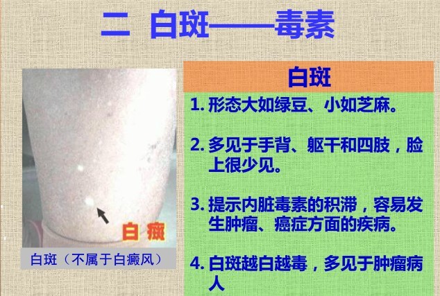 青筋跟血液循环有关吗,青筋的来源