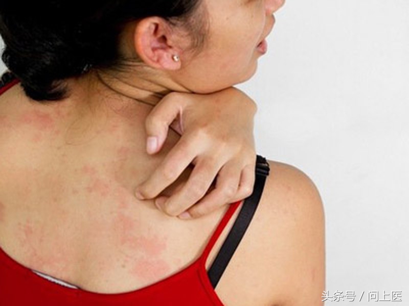 麻疹会传染吗是什么原因形成的,麻疹一定会传染给别人吗