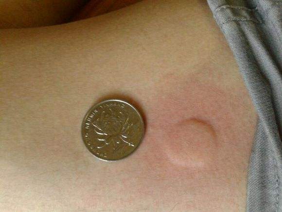 清凉油不为人知的妙用,清凉油不为人知妙用