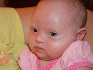 唐氏儿在医院怎么照顾,家有唐氏儿怎么办