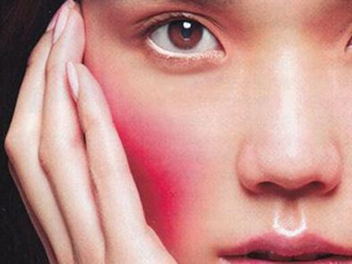 护肤不当发红用什么乳膏,护肤不当发红怎么办